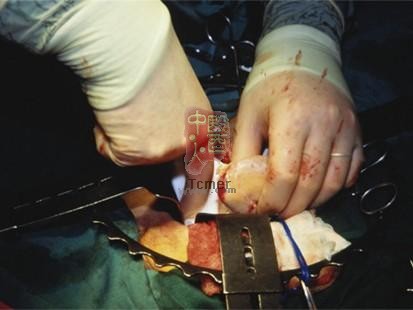 美国九大医疗事故:生殖医院错用精子(组图)