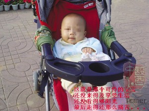 �ٷ�����ҽ����������ʧְ��5���´󻼶�����