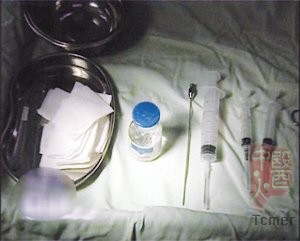 奥美定,把爱美的人“整”得好惨