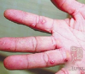 �����ϰٴ��񱻶�����ҧ��