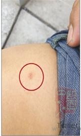 ���Ӵ򳵱�������ͷ��HIV���� Ů�������