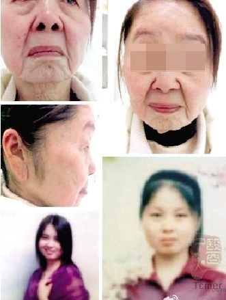 不敢上街,不敢照镜子不敢面对别人的眼神 不敢上街,不敢照镜子不敢面对别人的眼神