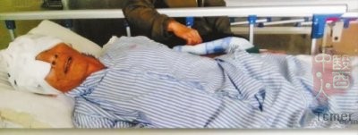 广东老人住院期间双眼被挖 院方称系自残
