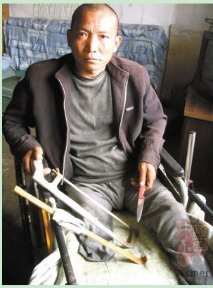 男子无钱治病自锯右腿