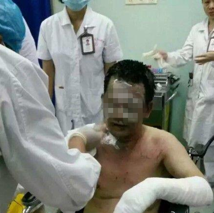 广西医科大一附院医生遭癌症患者泼汽油 重度烧伤已住进ICU