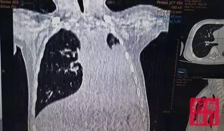 网传天津一医生黑心 医生:我成了东郭先生
