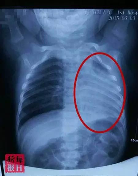 网传天津一医生黑心 医生:我成了东郭先生