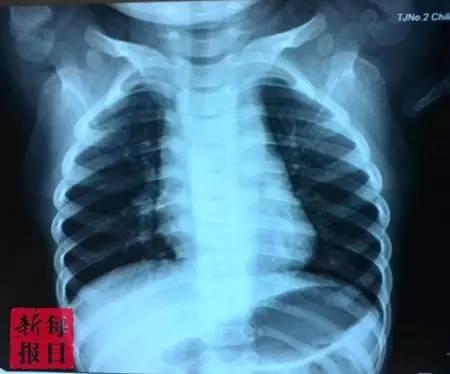 网传天津一医生黑心 医生:我成了东郭先生