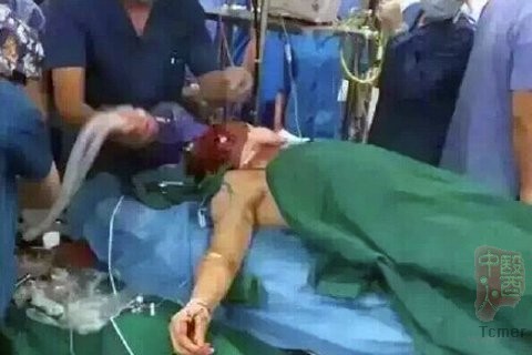 医生王建军面部颈部被砍。图片来源网络