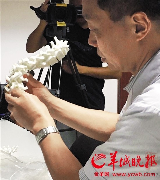 3D打印脊椎助14岁'蜘蛛人'挺直腰杆 术后'长高'十厘米 3D打印脊椎助14岁'蜘蛛人'挺直腰杆 术后'长高'十厘米