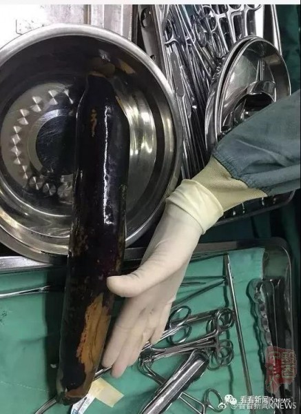 ΢��ͼƬ_20180605151759.jpg