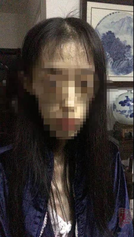 21��Ů��������50�� 2���Գ�Ѫ����֯��60��