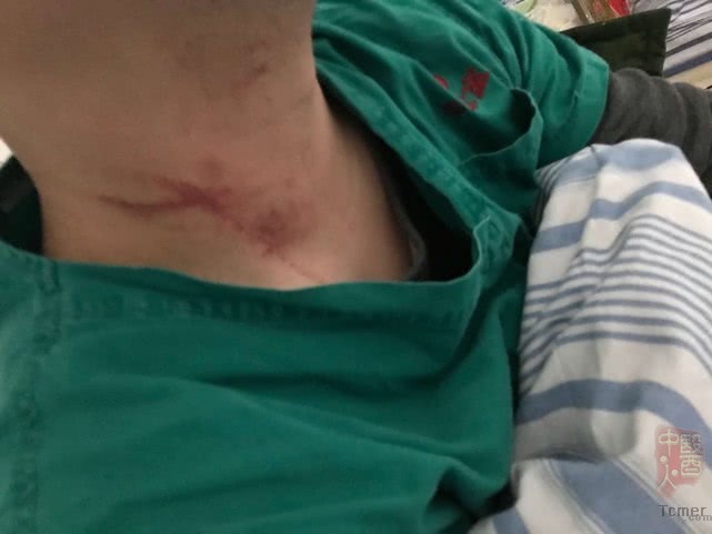 �人�����������ͷ��׾���ҽ�������߼������� 