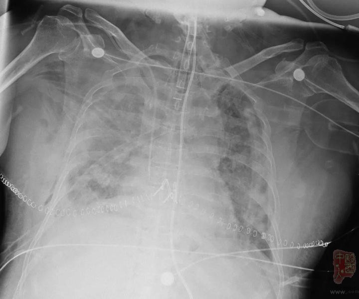 ??????.jpg