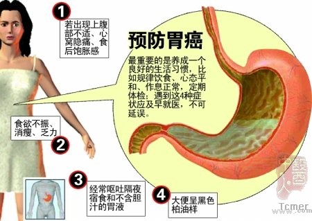 白领注意!每天喝酒应酬 37岁经理喝出胃癌