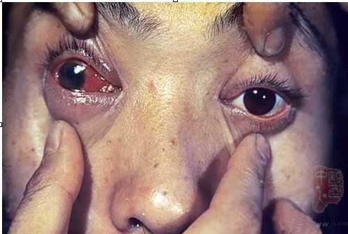 /health/UploadFiles_4020/201209/20120925113043191.jpg