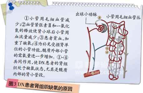 inserted image