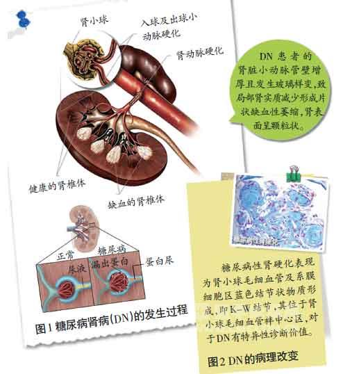 inserted image