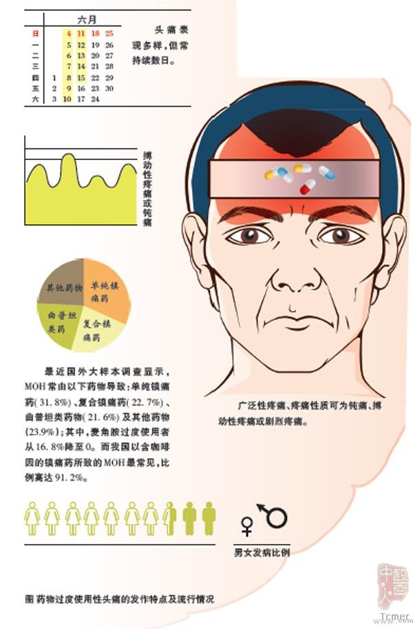 药物过度使用性头痛的诊治