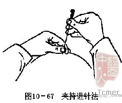夹持进针法